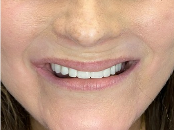 e81712_30219ca8540646ec955199b1c596ed5f~mv2