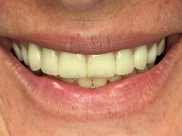 e81712_58132d08397c45dea26ef57f7aea573b~mv2