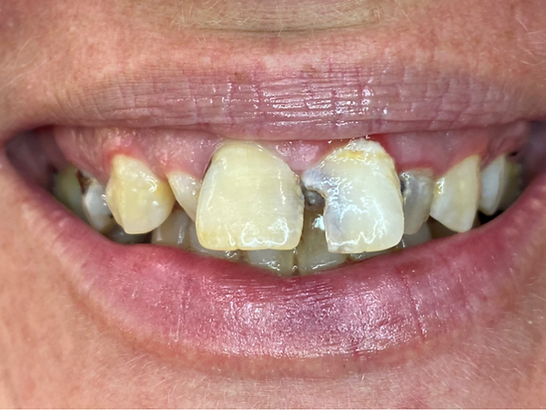 e81712_72b2d4c28058430192cffc1f68bf4888~mv2