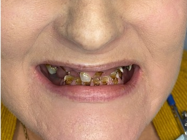 e81712_d20ea521409f4a1da4b124e6e04facce~mv2